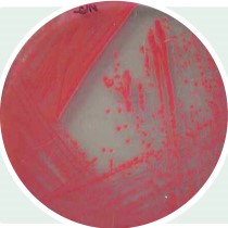 假單胞菌 假單胞菌